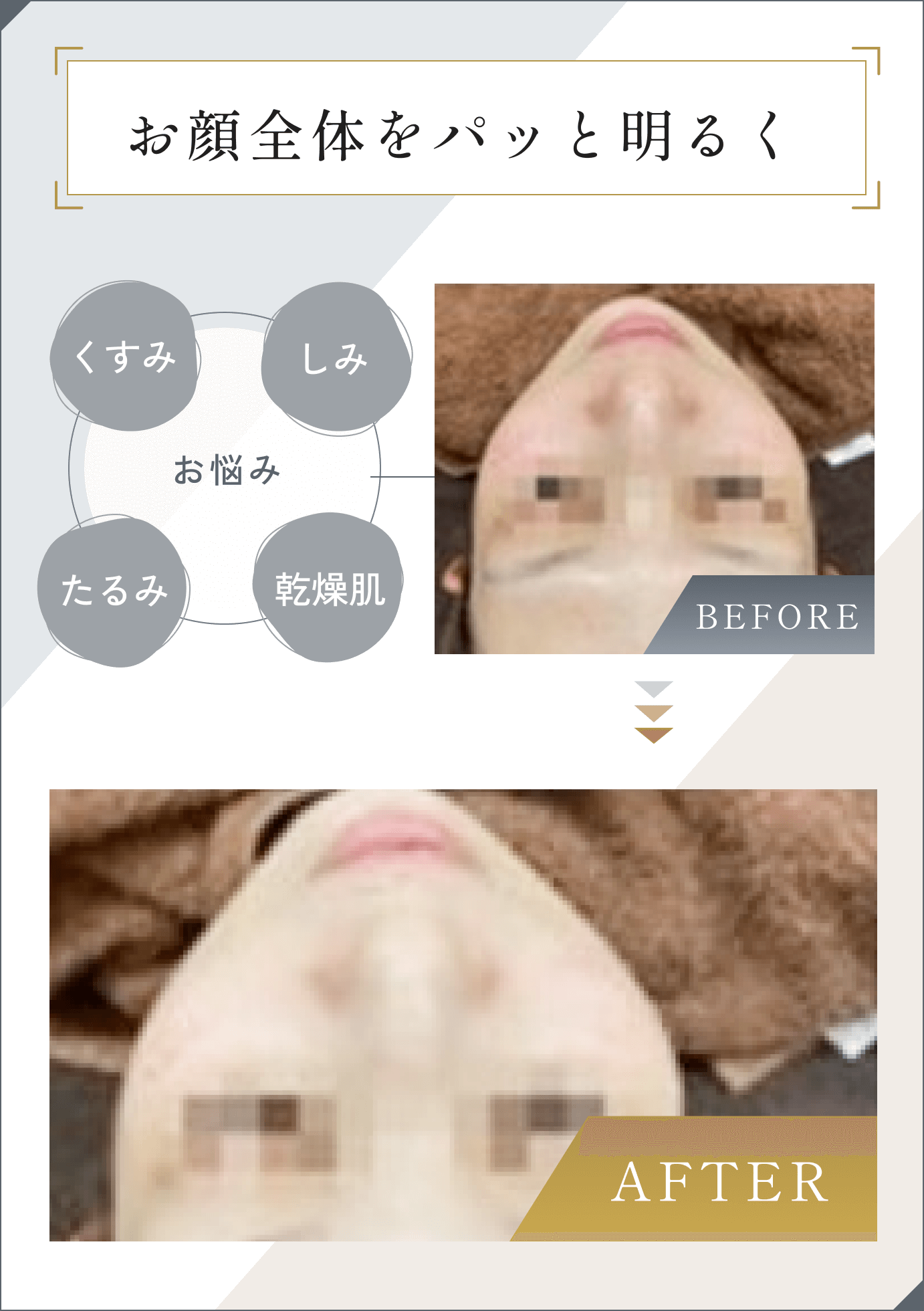 お顔全体をパッと明るく